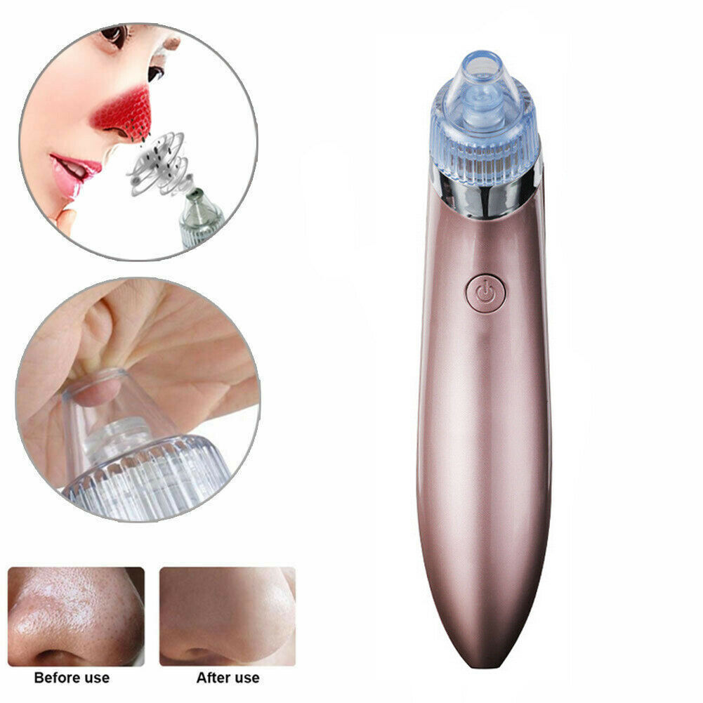 "Revitalize your skin with our Electric Blackhead Vacuum Pore Cleaner. Say goodbye to acne and blackheads!"