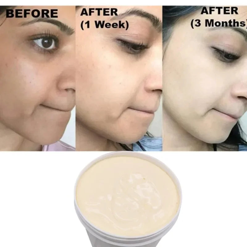 Best Bleaching Whipped Whitening Cream 1KG No Side Effects for Dark Black Skin Whitening Bleaching Cream