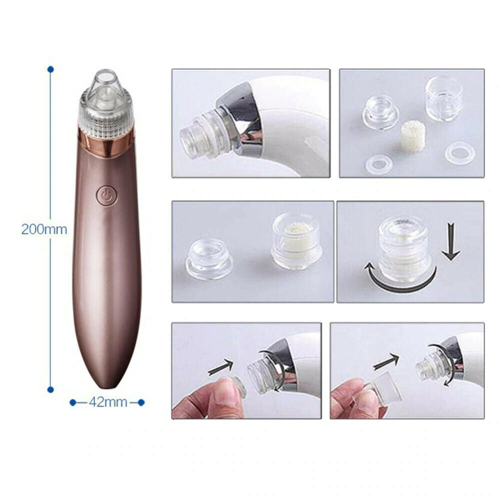 "Revitalize your skin with our Electric Blackhead Vacuum Pore Cleaner. Say goodbye to acne and blackheads!"