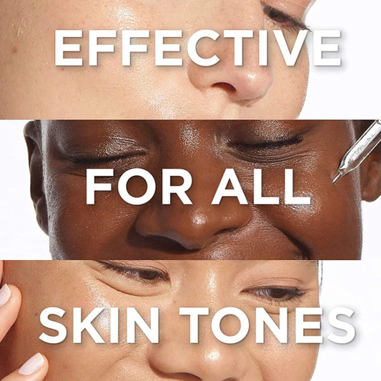 Best Bleaching Whipped  Whitening Cream 1KG No Side Effects for Dark Black Skin Whitening Bleaching Cream